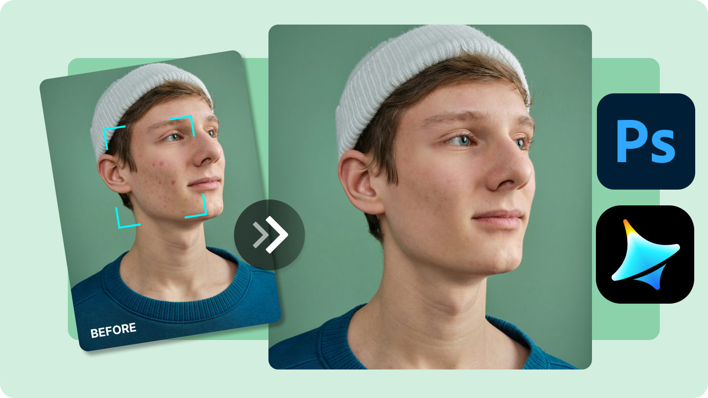 how to clear pimples in photoshop 