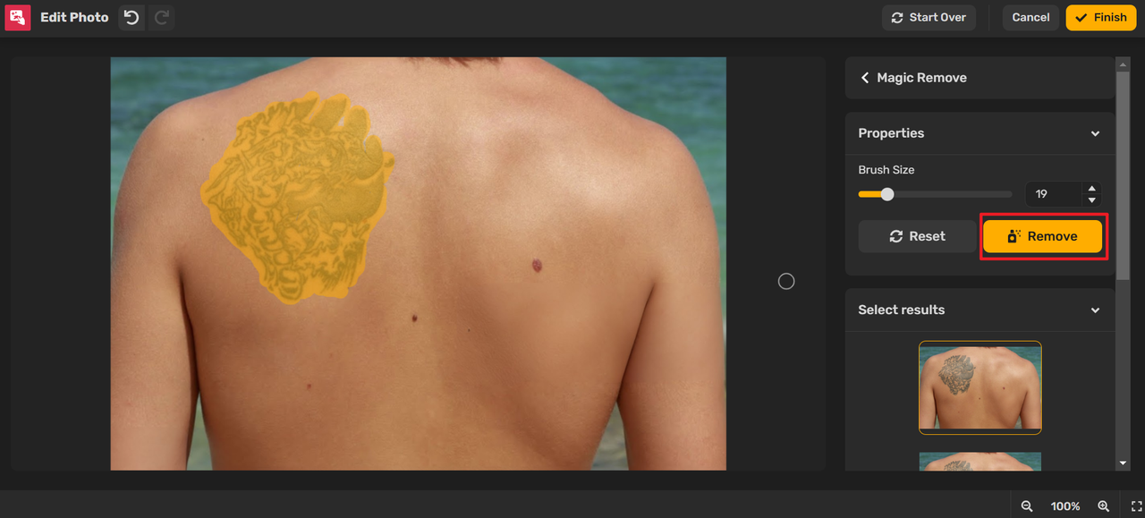 remove tattoo with ai tattoo removal